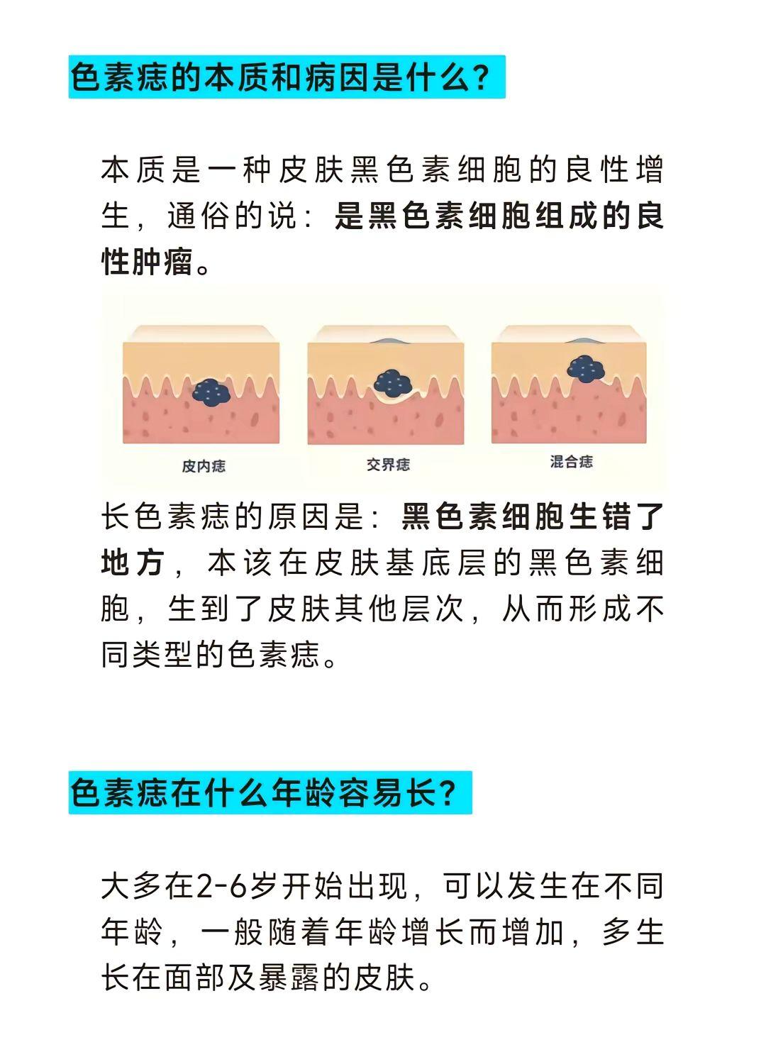 小小的痣，大大的纠结。