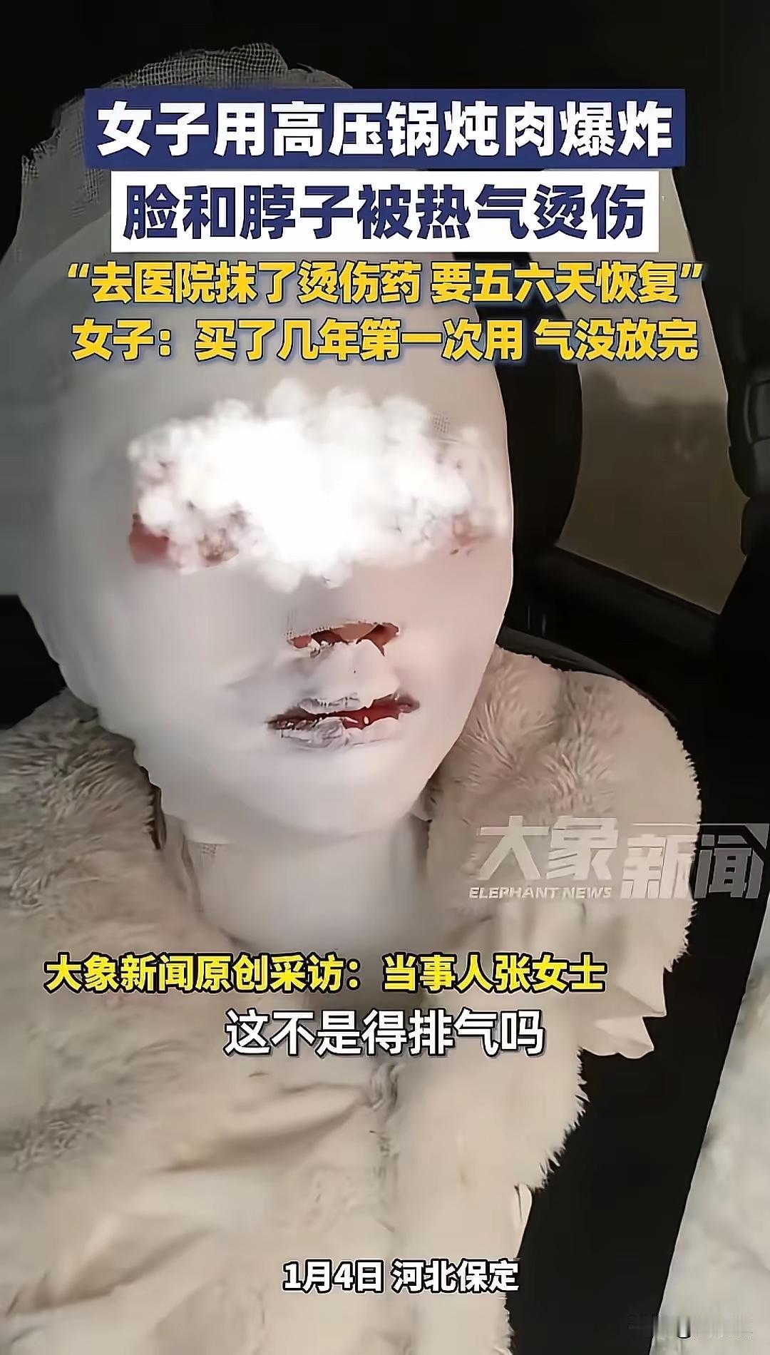 河北保定，一女子用高压锅炖肉，眼看着高压锅上面的小红盖掉下去了，她以为锅已经没气