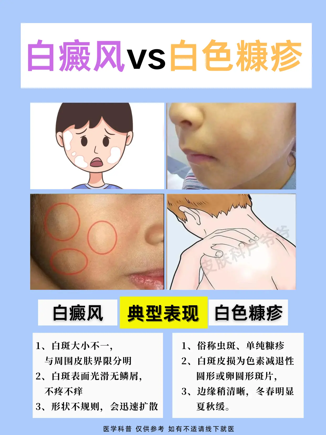 常见白斑辨别
