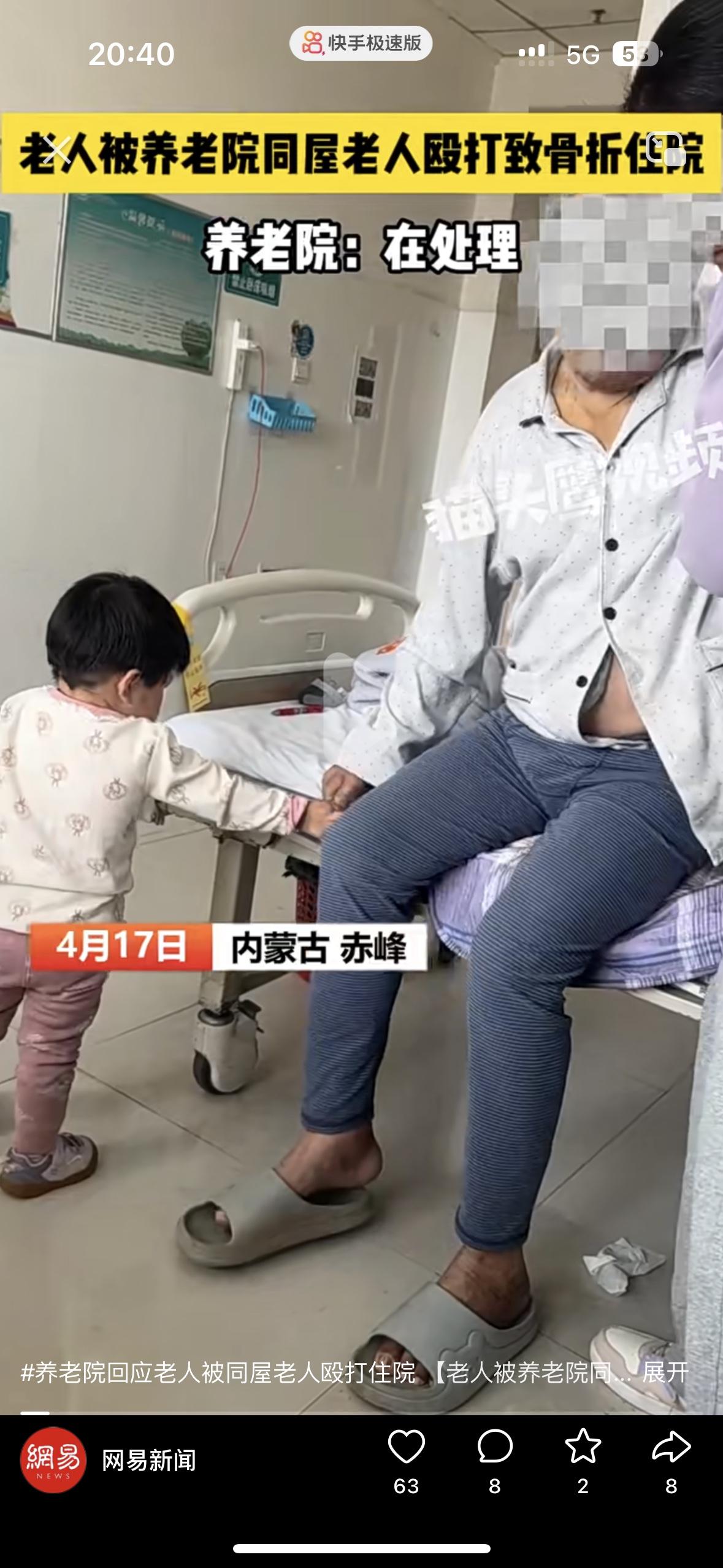 自己的老父亲在养老院被人打了，不是护士，也不是医院的人，而是自己同房的老人
搁谁