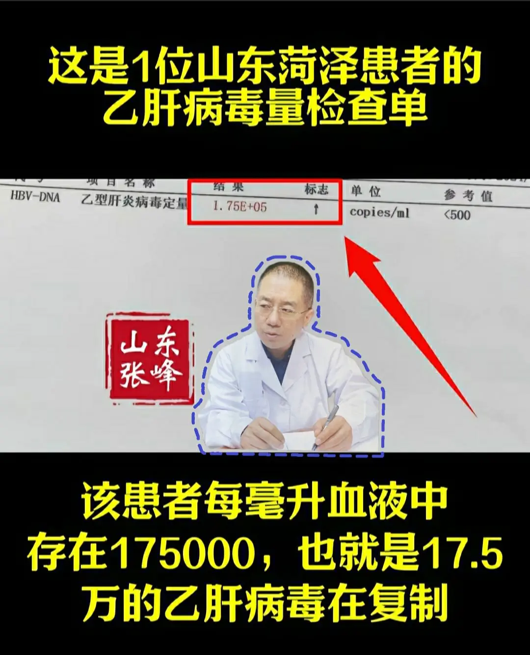 山东 每天跟我涨知识 乙肝 医学科普