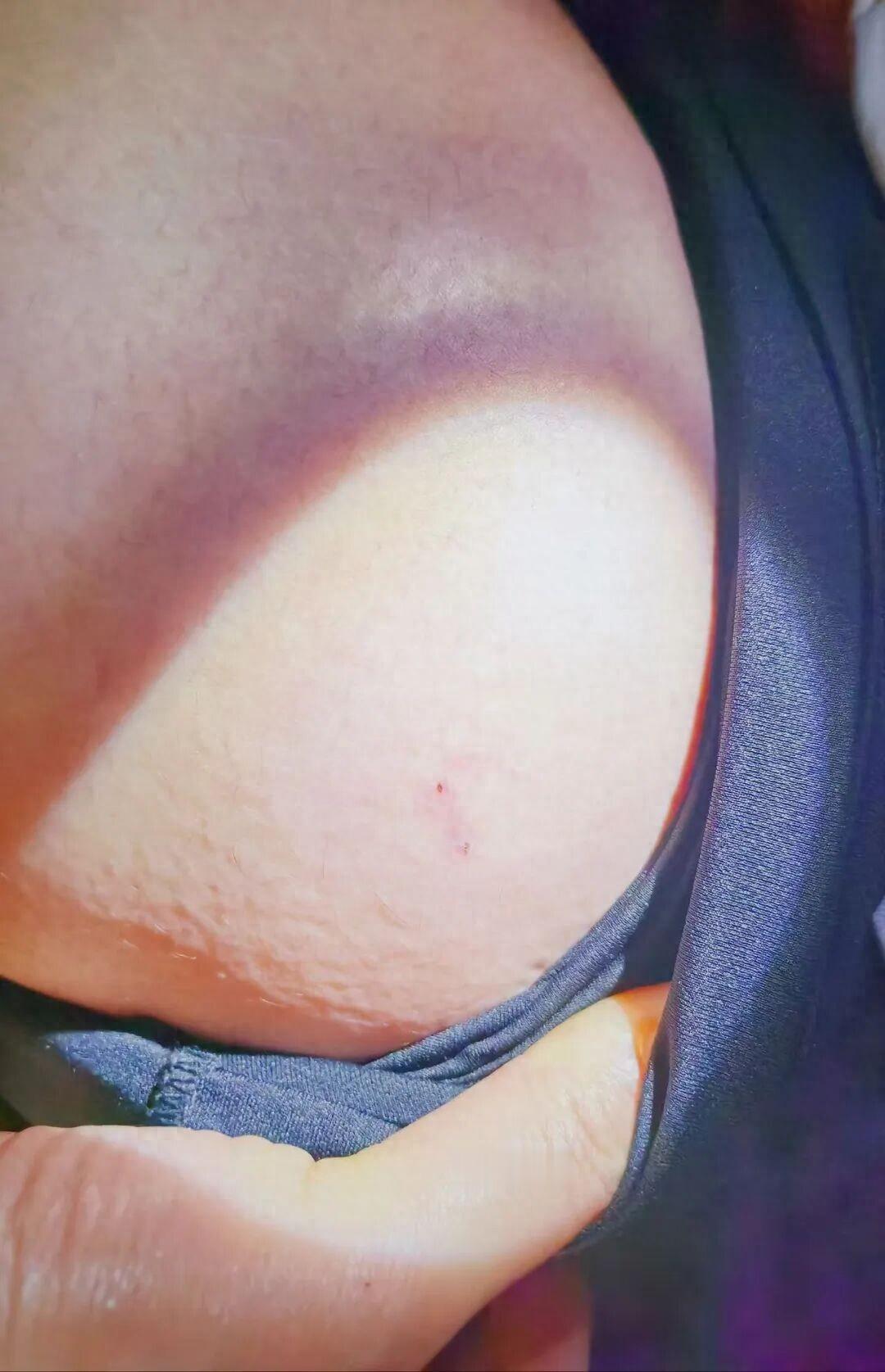 万万没想到！湖北武汉，一名大二女生一夜之间像变了一个人，情绪变得烦躁不安，自言自