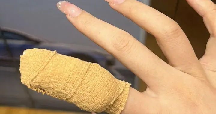 女子做家务时突然一阵钻心疼，指甲直接断裂渗血！很多爱美女生一直这么干，医生：一年别超4次
