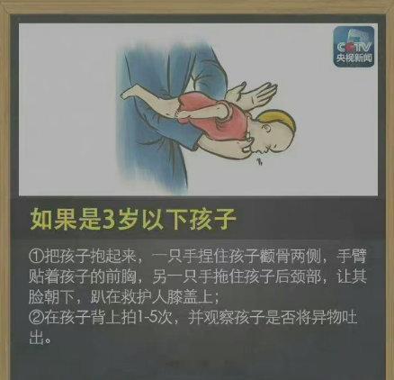 【异物卡喉？吞咽、猛拍更危险！】生活中被异物卡喉的情况时有发生，特别是儿童。吞咽