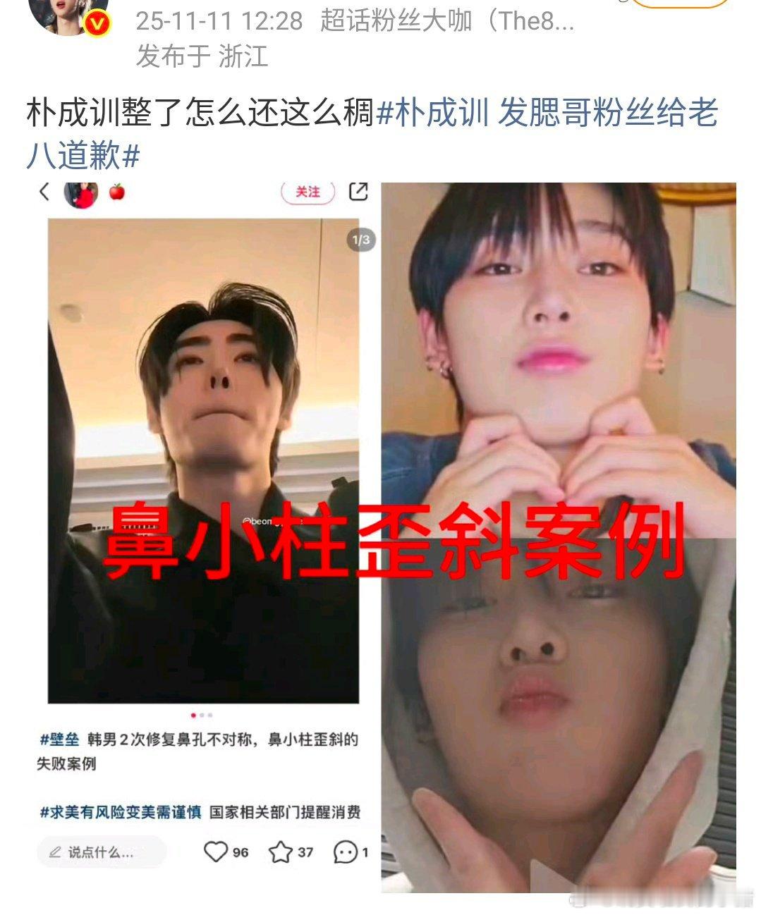 徐明浩粉丝怎么上了朴成训 gc 了[震惊][震惊] ​​​