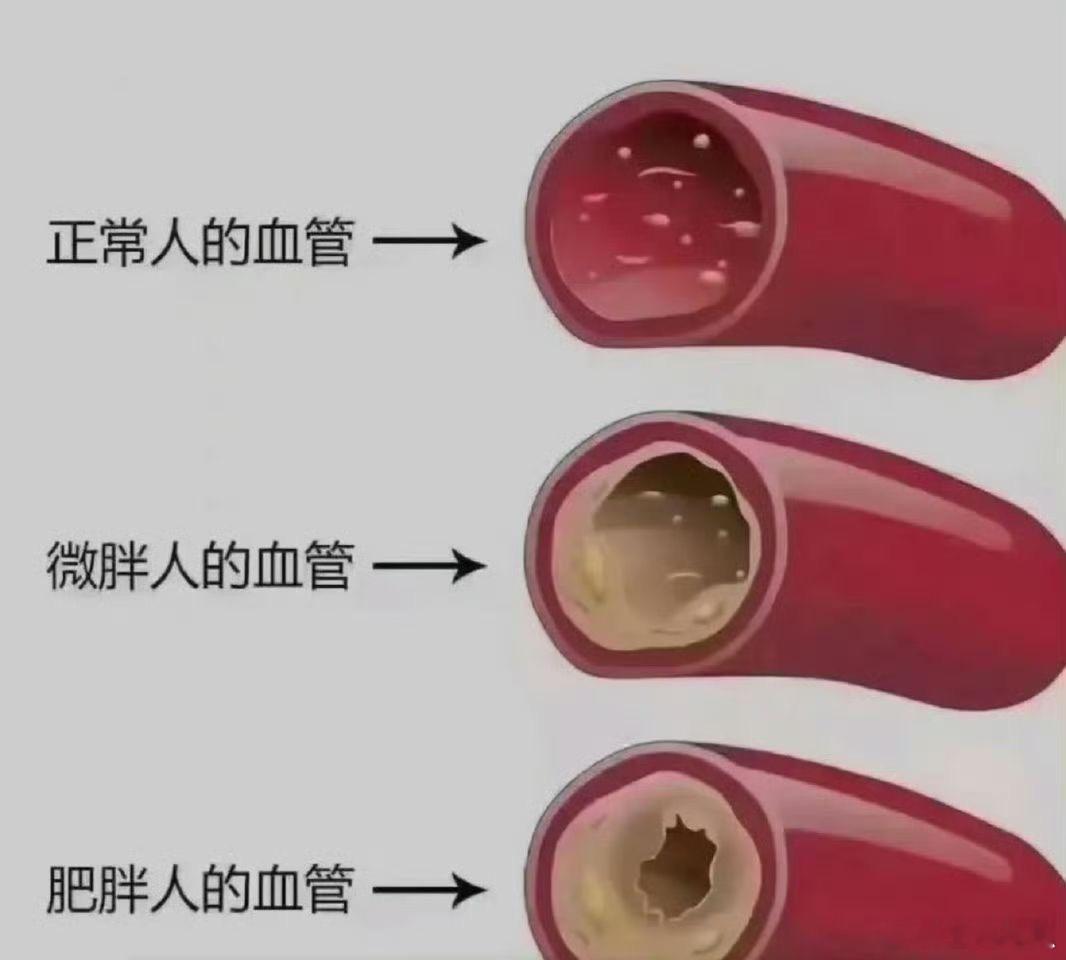作为一个胖子，瑟瑟发抖ing 