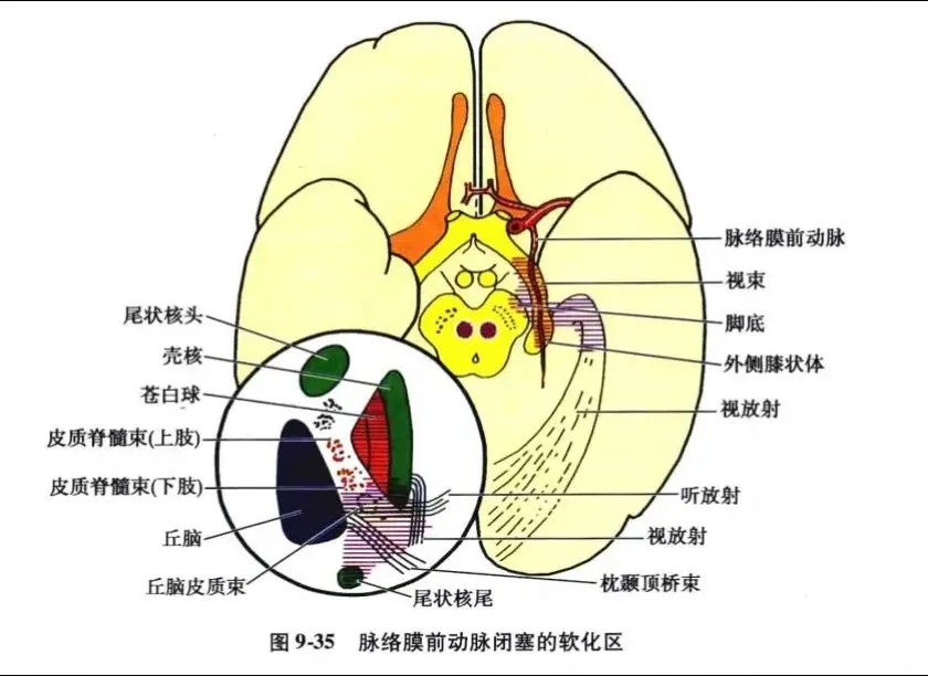 脉络膜前动脉。