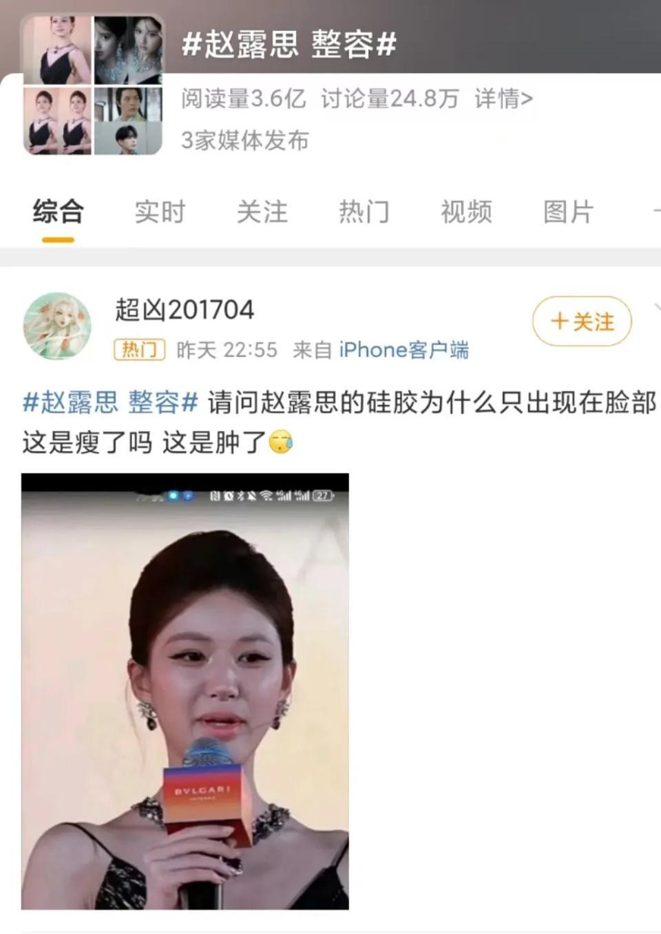 赵露思近期外貌变化引发关注，关于是否整容众说纷纭。娱乐圈女明星为求上镜效果，常会