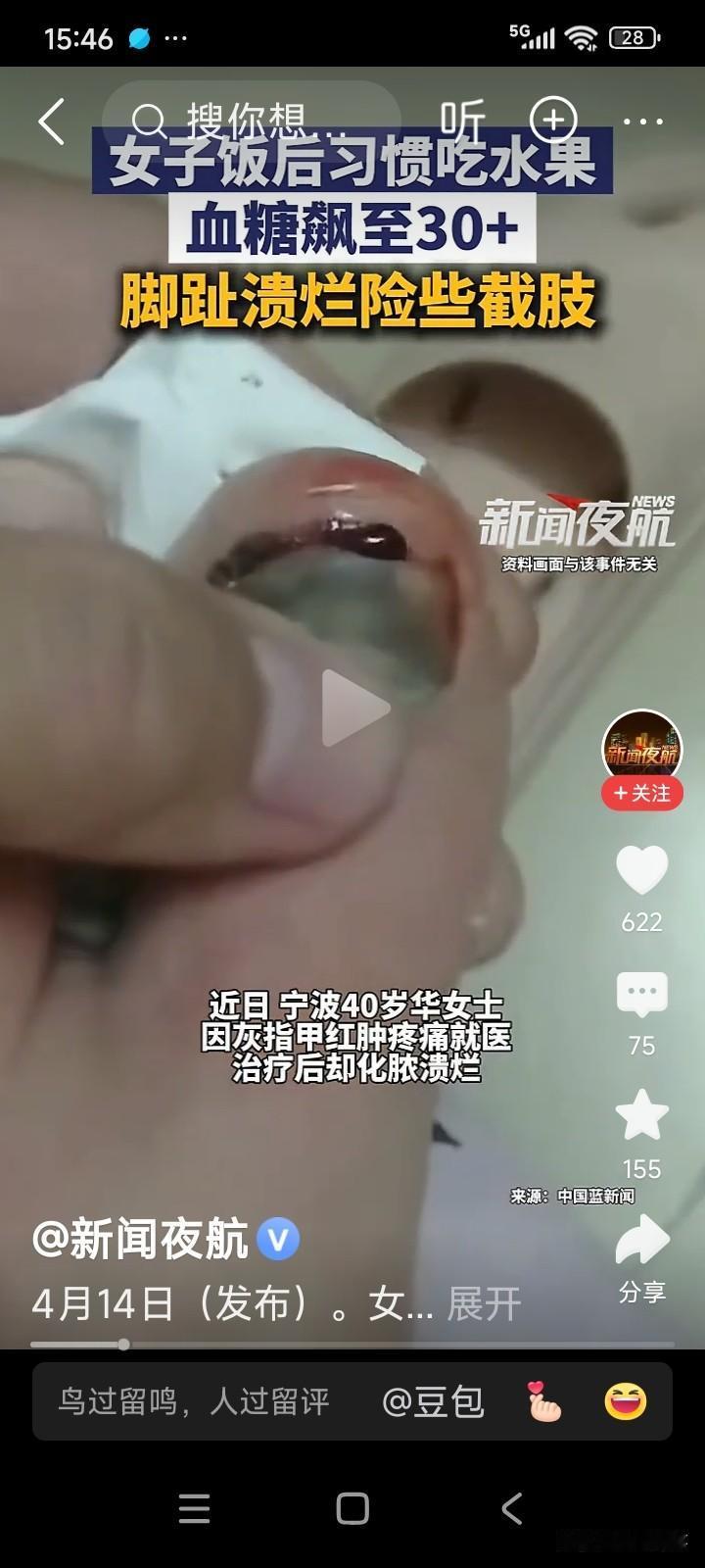 浙江宁波，有一位40岁的女子，喜欢饭后吃水果，时而吃苹果，时而吃梨，时而吃橘子。