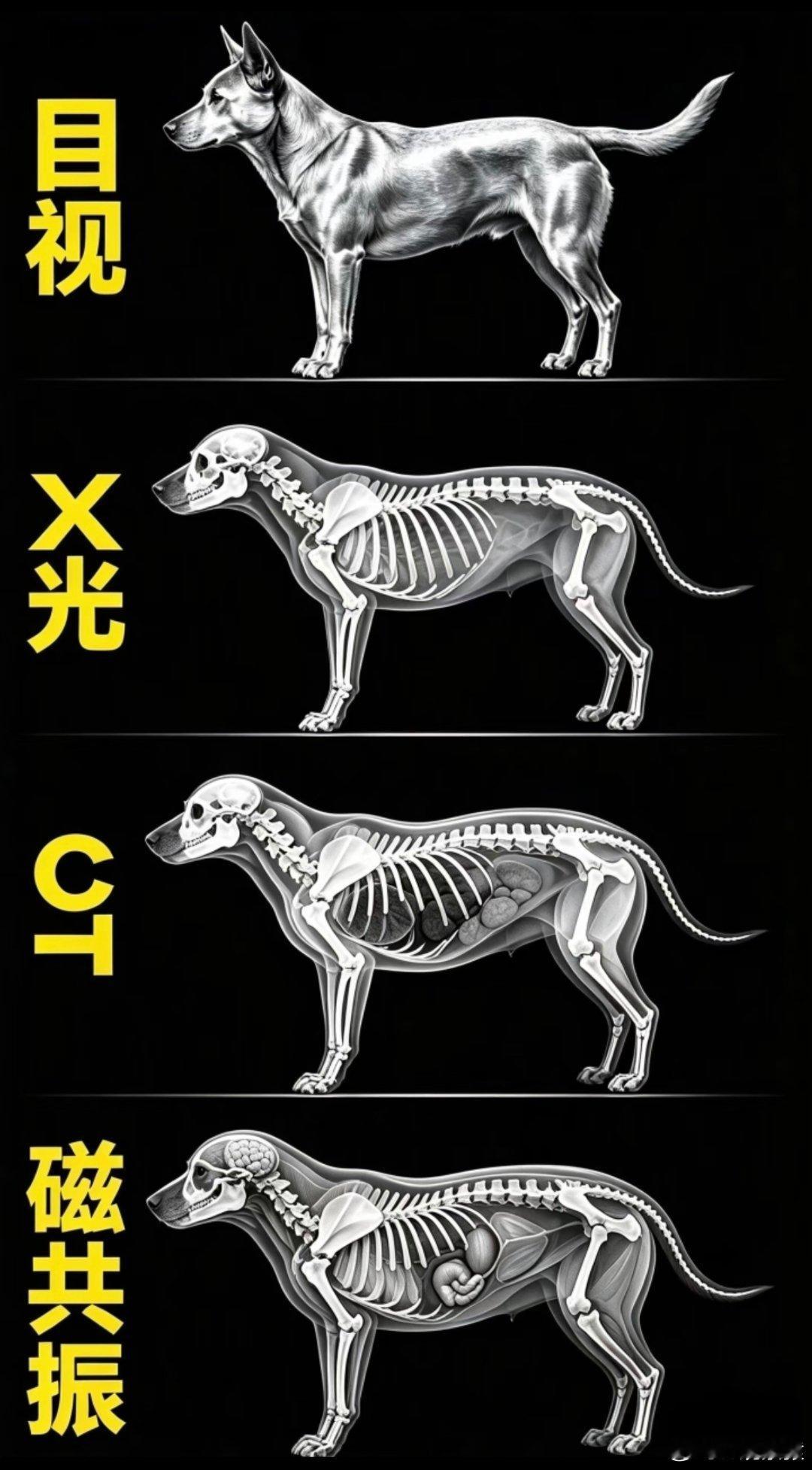 核磁共振为什么这么贵X光：拍影子，快、便宜、辐射小，看骨折、胸片，但重叠看不清。