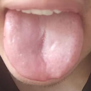 脾肾亏虚拖垮体质？科学调补，养回内在元气






很多男同志出现功能问题并不
