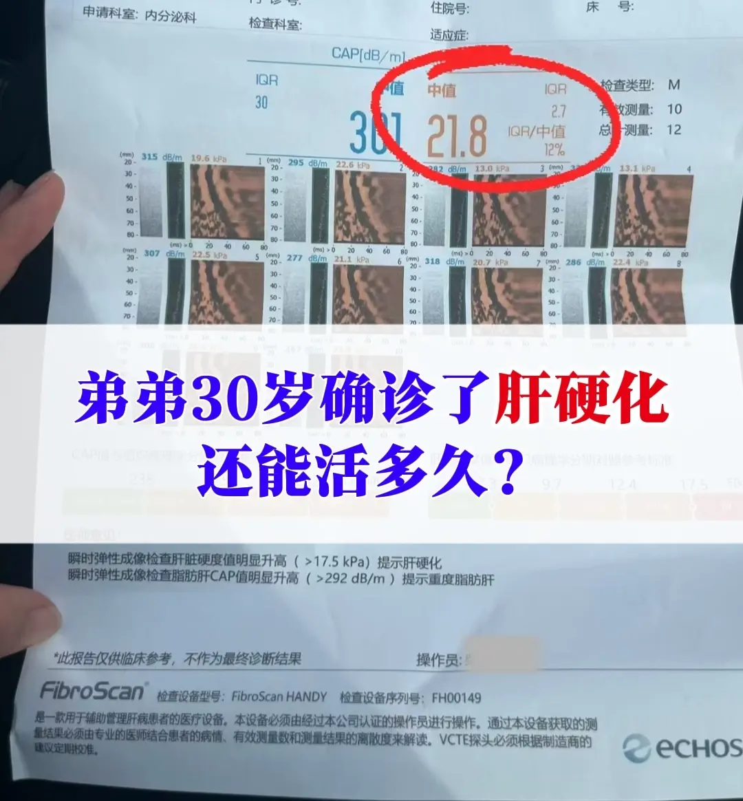 前几天专家门诊来了位姐姐，让我印象很深刻，这位女士是为自己的弟弟咨询的...