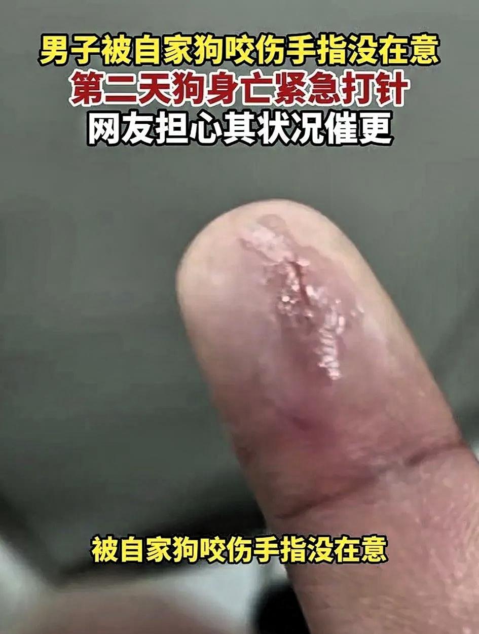 河南，一男子被自家狗子咬伤手指后没在意，结果第二天狗子突然身亡，吓得男子赶紧到医