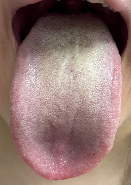 你看病，不听医生话，即便是灵丹妙药，你也好不了啊！

我每天都在说这个脾有问题，