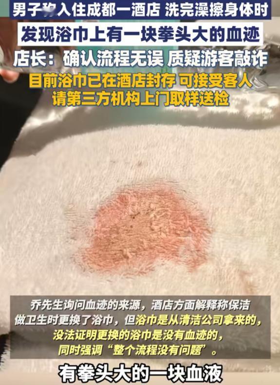 成都一男子男住酒店，
洗完澡刚要拿毛巾擦身，
直接吓出一身冷汗！毛巾上居然

有