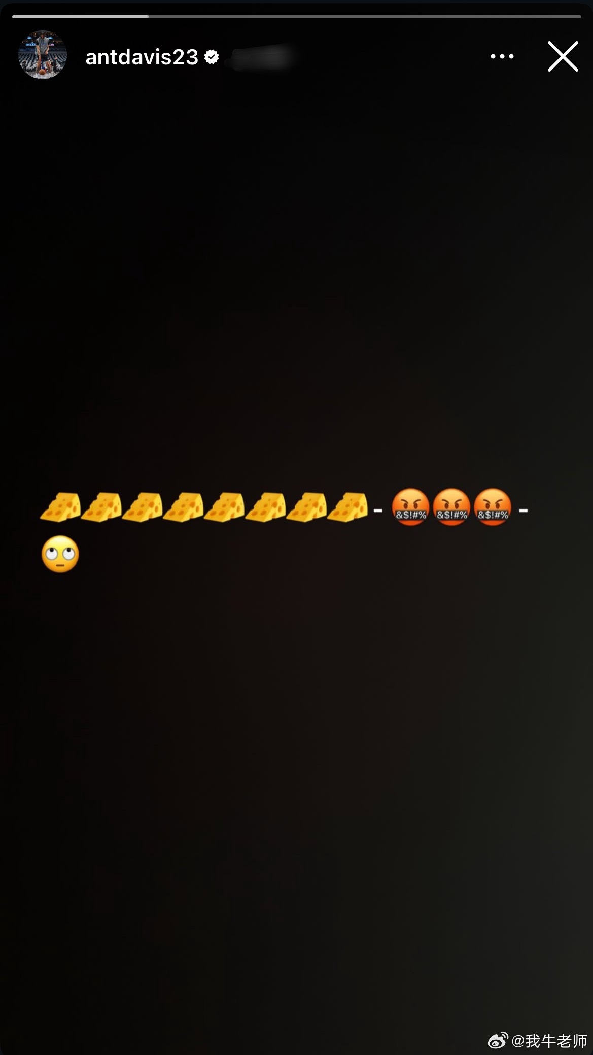 MFFL 戴维斯最新的IG。独行侠vs湖人浓眉有望对阵湖人复出独行侠将听取浓眉交