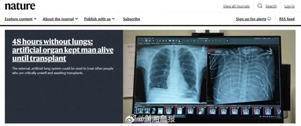 【#人类首次实现48小时无肺生存#，为肺移植提供“窗口期”】近日，《自然（Nat