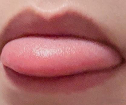 舌头👅痛痛的 
