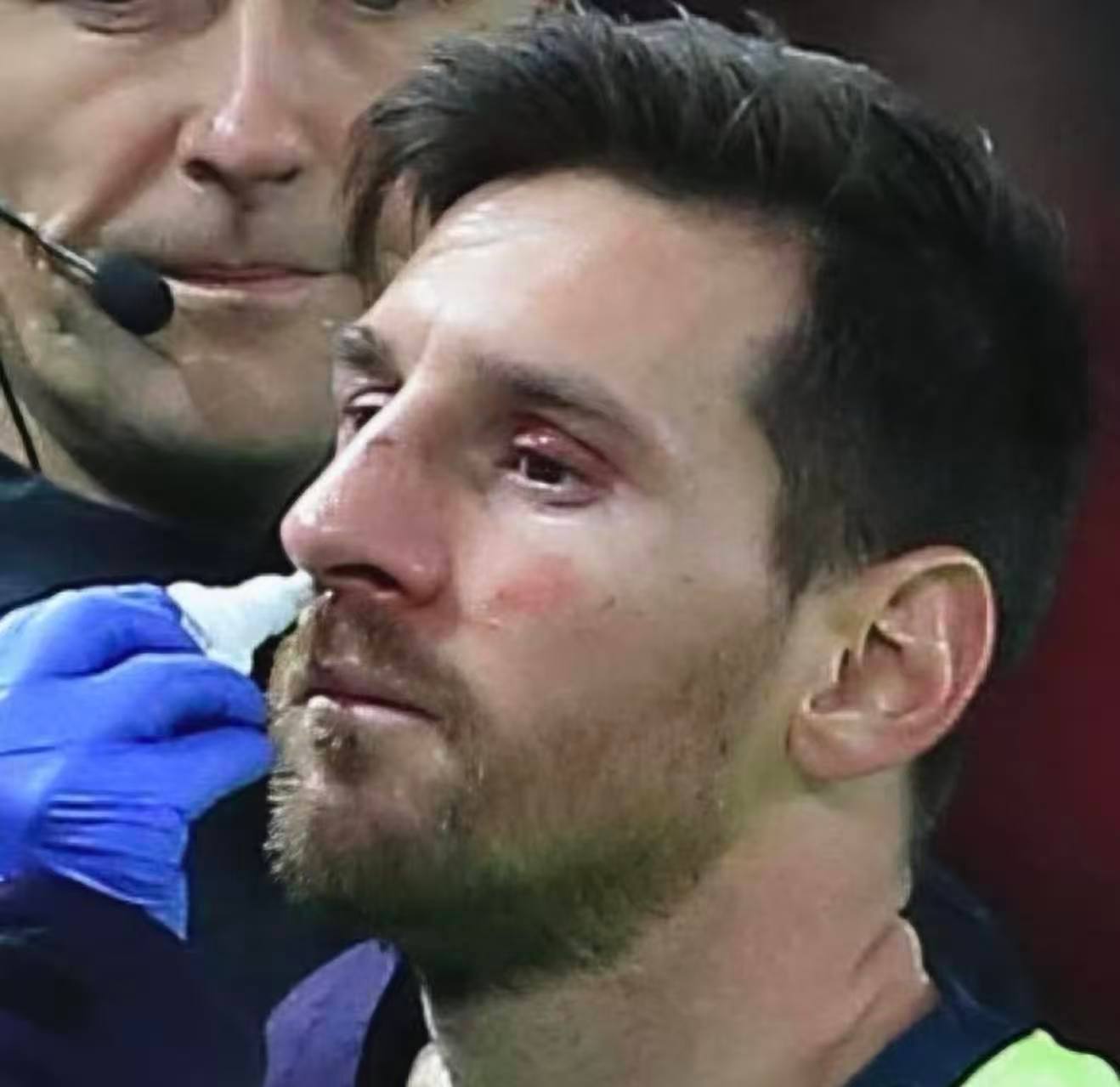 战损小梅🥺梅西