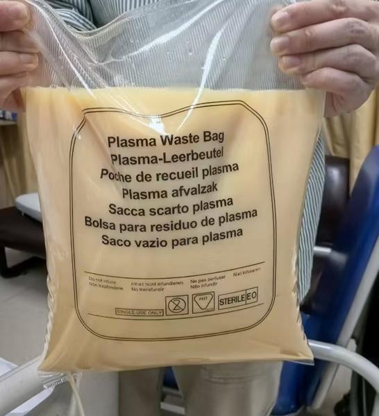 男子聚餐又去夜宵，夜宵后体内过滤出7斤油，吓坏家人。

春节已经结束，相信大家在