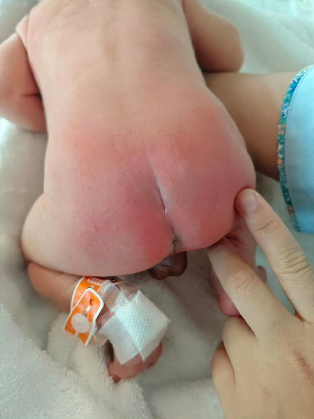 【纸尿裤：检出毒性物质甲酷胺】　
《经济参考报》委托检测发现好奇、碧芭宝贝、Ba