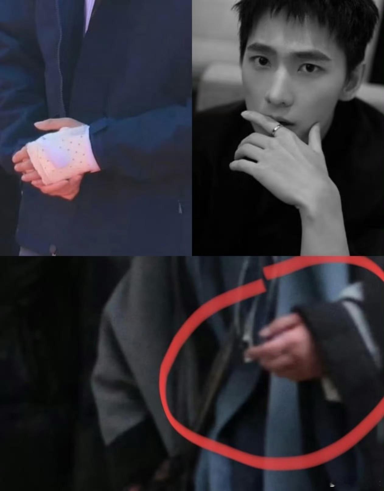 杨洋的手好肿这是干嘛呀？未免太过分了吧！说好的会照顾好呢？就因为他没以前那么🔥