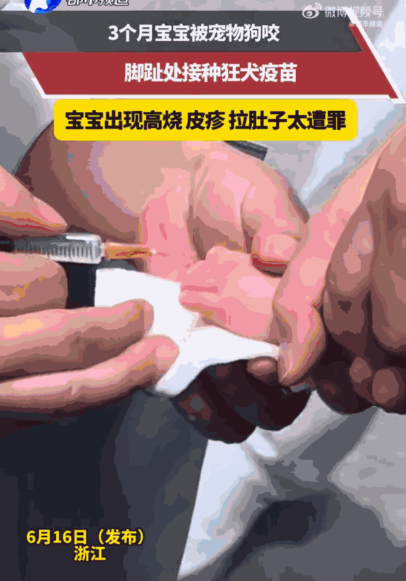 防不胜防！浙江一名3个月的宝宝，正安静喝奶，谁知邻居家的狗竟突然窜出，一口咬住了