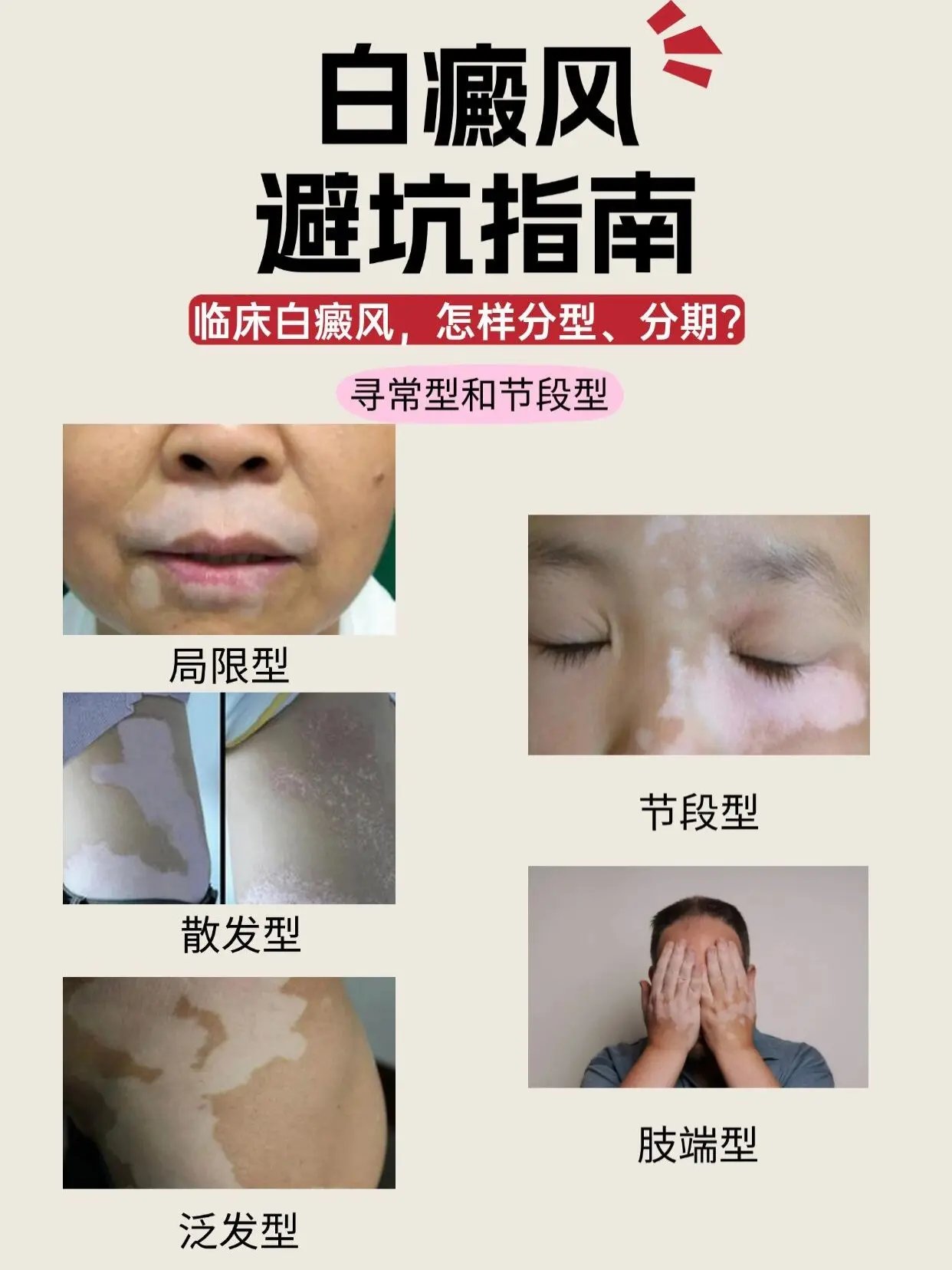 医学科普 白癜风 白癜风科普 抖出健康知识宝藏  白斑