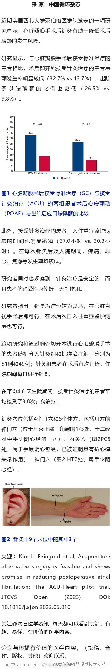 针灸，可防瓣膜术后房颤！？美国研究近期美国西北大学范伯格医学院发表的一项研究显示