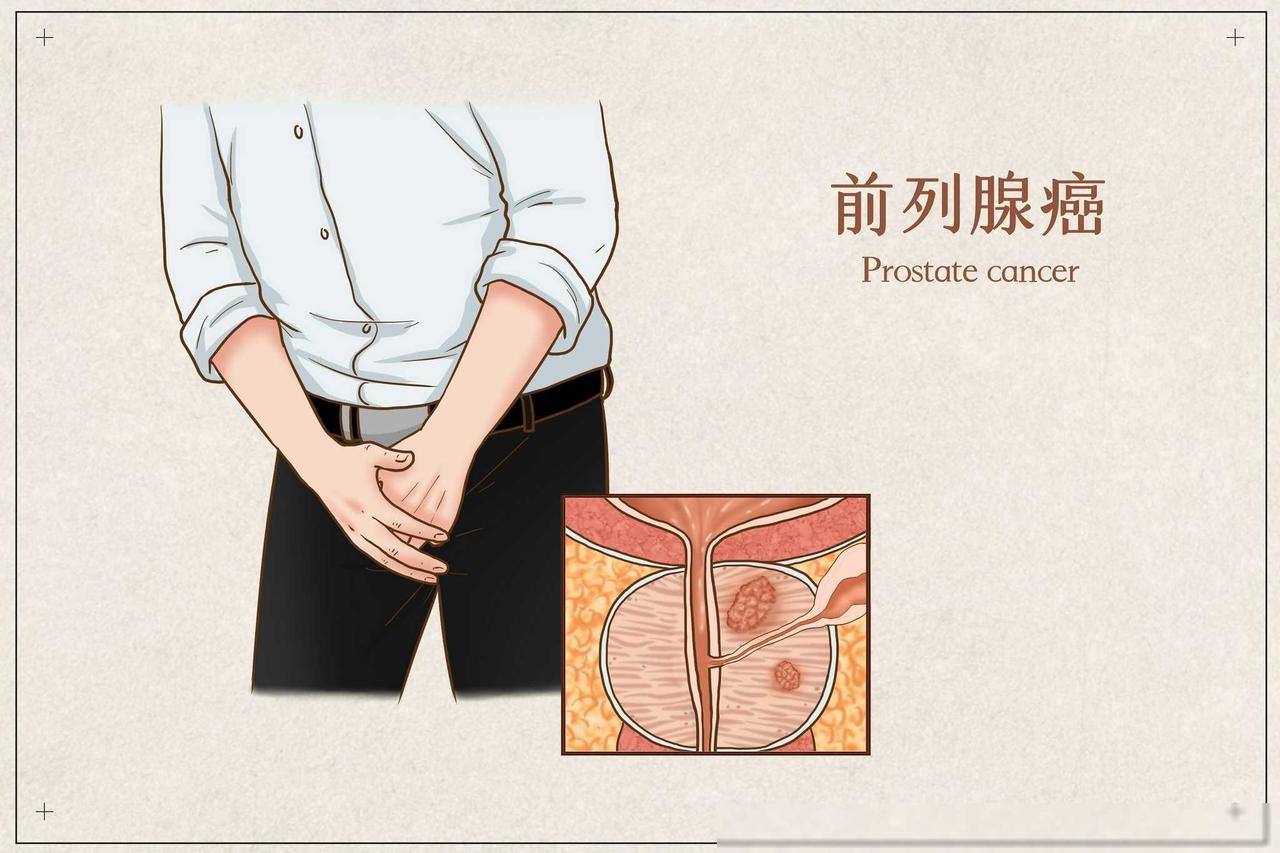 你们听说过个体化治疗吗？就拿前列腺癌来说，大家都知道这个病治疗起来特别复杂，而且