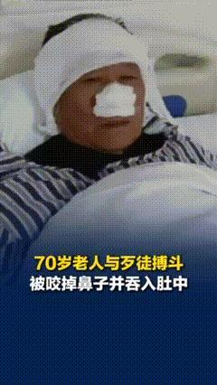 湖南70岁老人与歹徒搏斗被对方咬掉鼻子并吞入肚中，当地回应：将申报见义勇为，并协