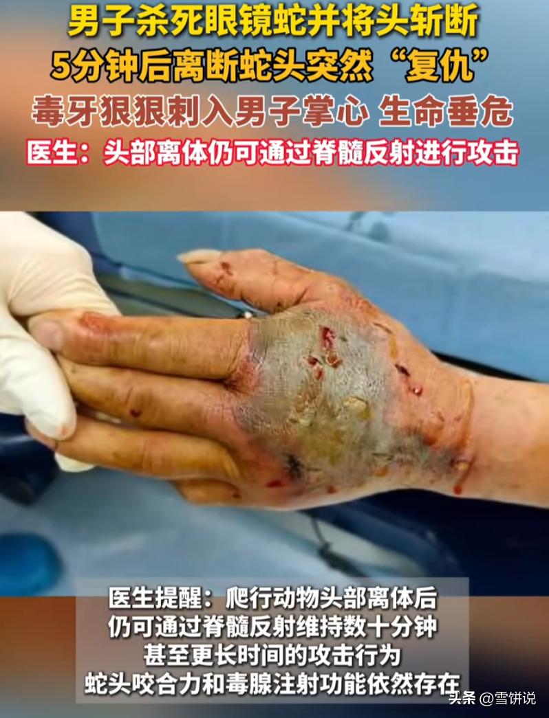 千万别以为蛇断气就没危险！浙江诸暨，一位72岁大爷野钓途中偶遇剧毒眼镜蛇，果断挥