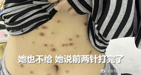 花800元买猫却被传染全身长猫藓 治疗花费已近千元3月6日消息，据媒体报道，江苏