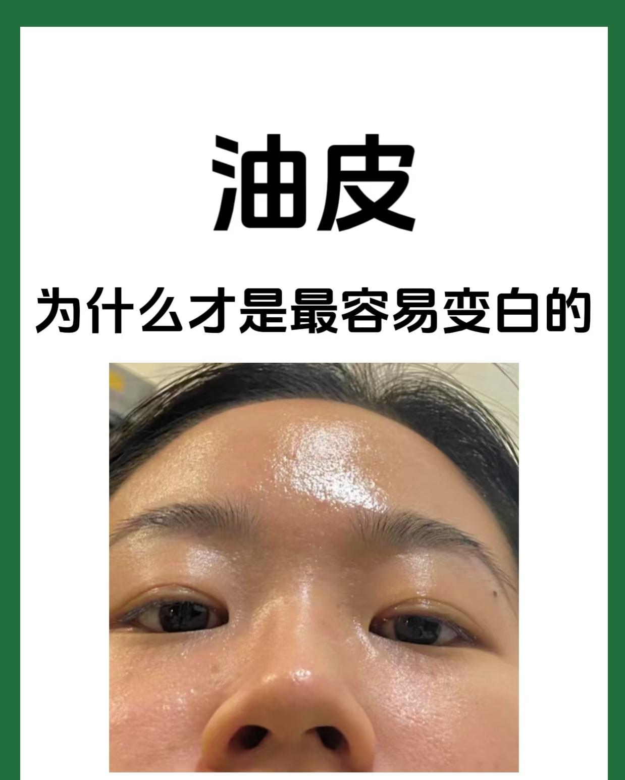 以油养肤”骗了你多久？油皮真正的“救星”是它，别再做错了！
是不是总觉得脸上能“