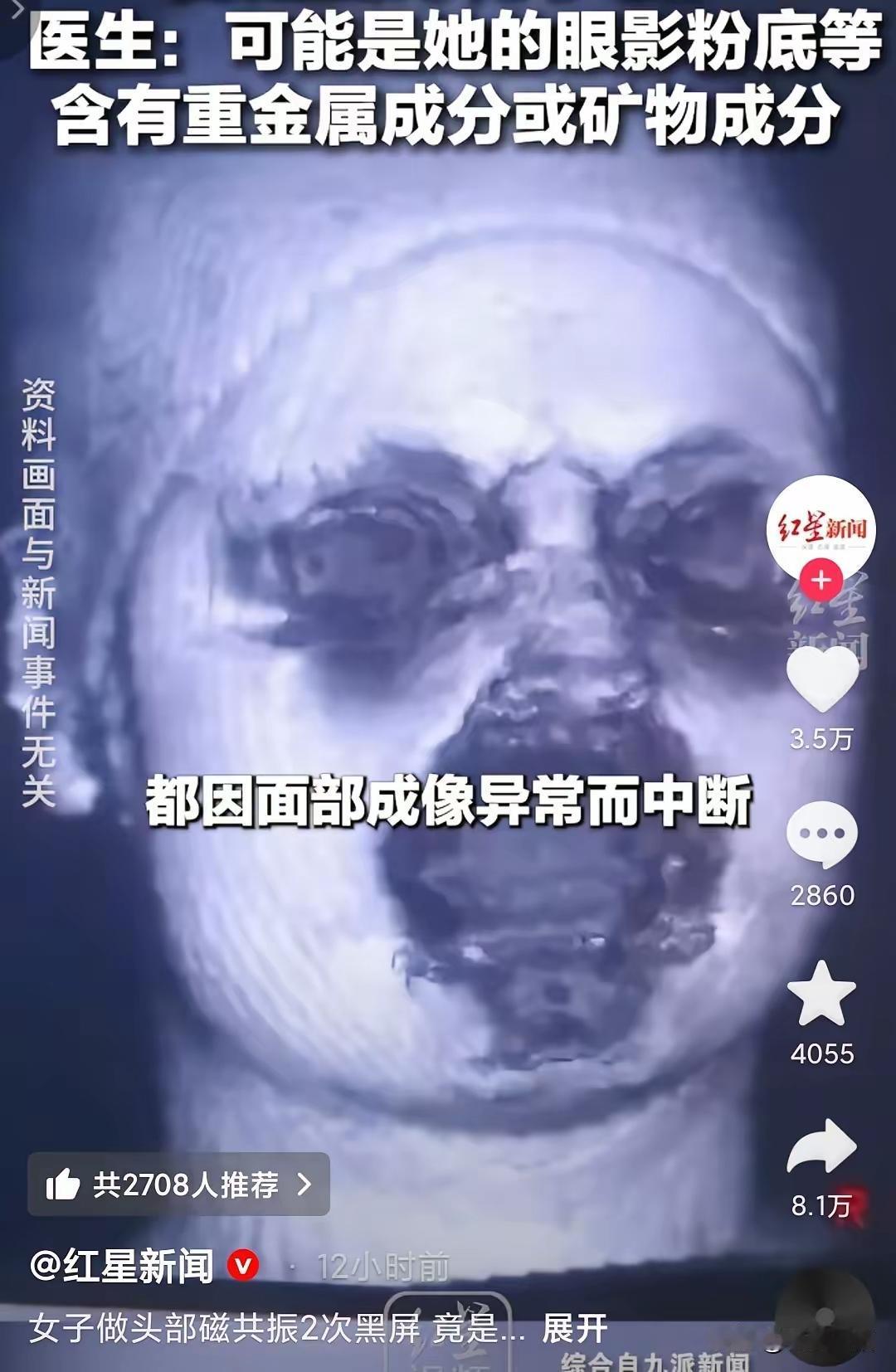 女子去医院做核磁共振，意外发现自己的化妆品里面可能含有重金属。因为头晕去医院做核