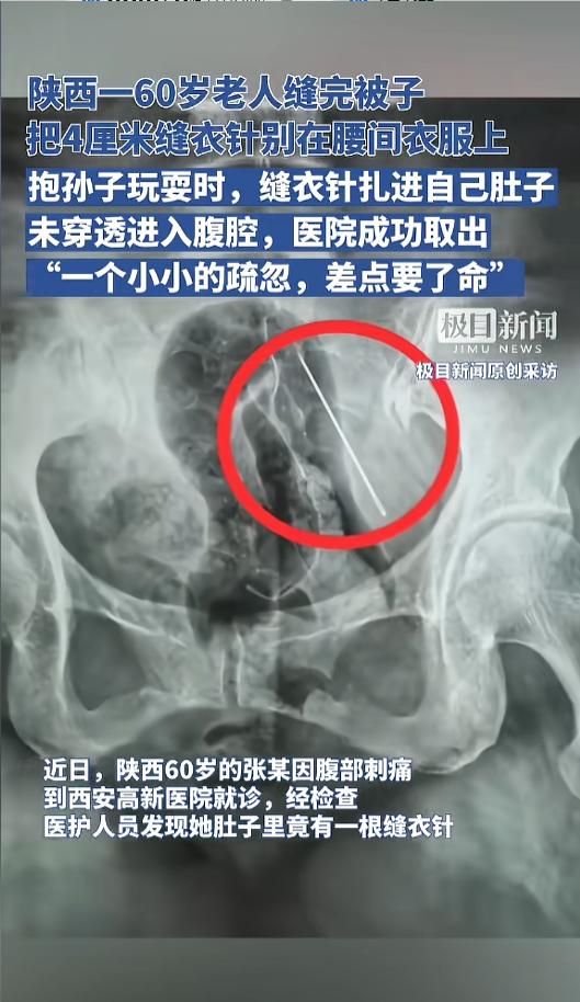 “离了个大谱！”近日，陕西，一位六十岁的老人因为腹痛到医院就诊。医生检查后，竟在