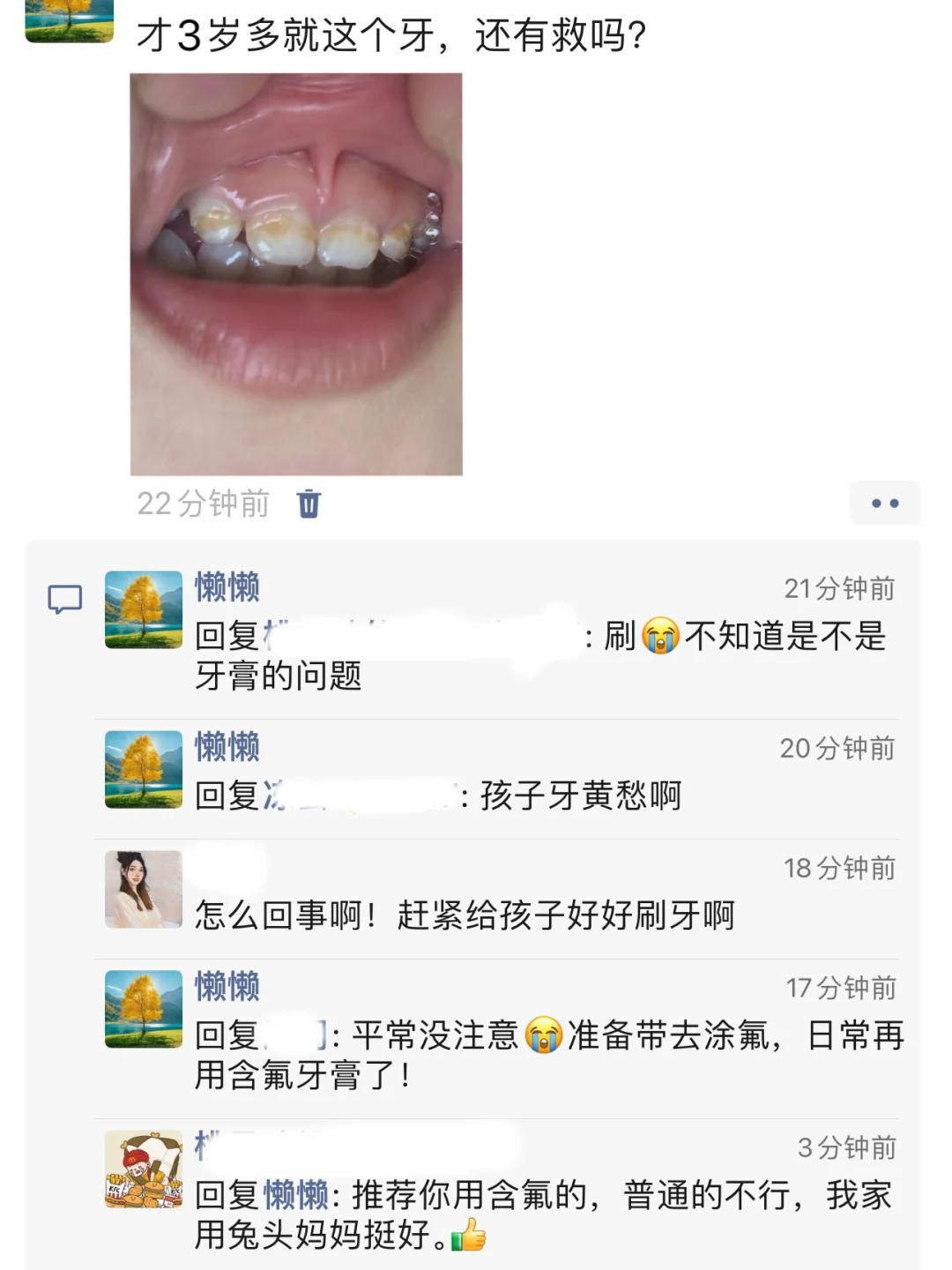 宝宝牙齿发黄丑丑的？一招教你解决！