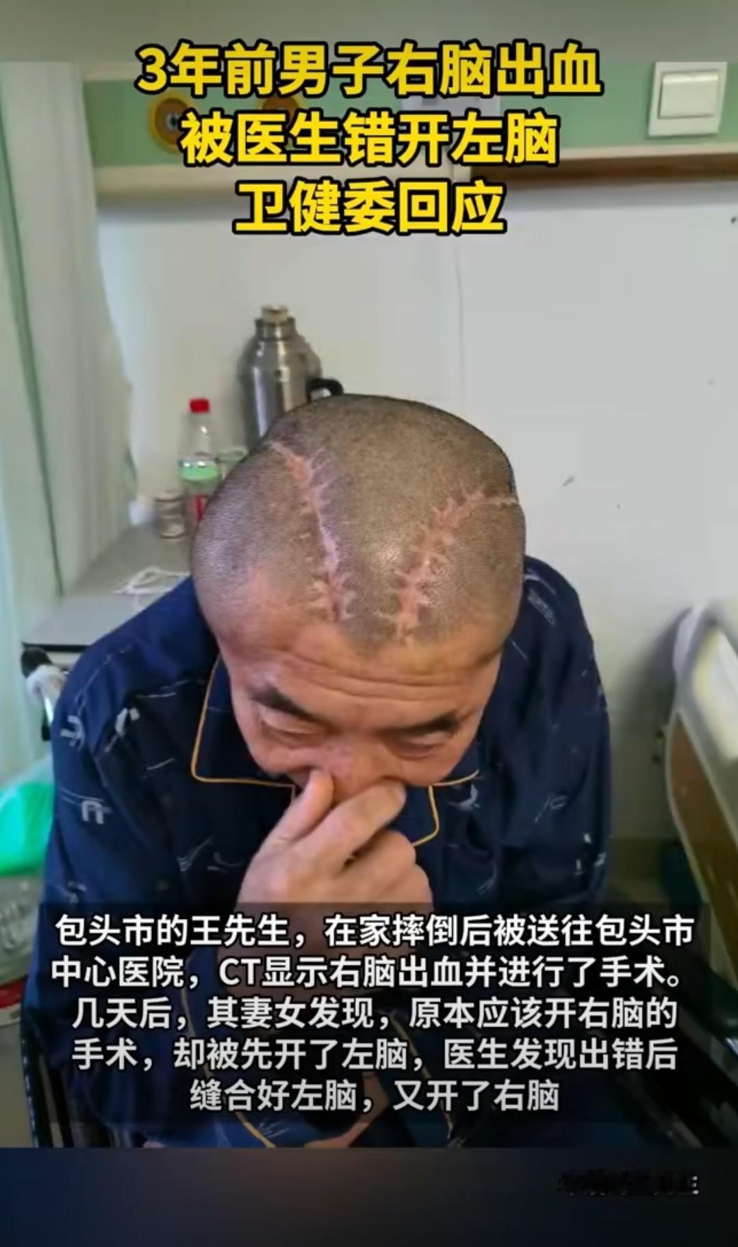 刚在家庭群看到这新闻，手一抖，茶水洒了半杯

右脑出血给左脑开刀？这哪是马虎，这