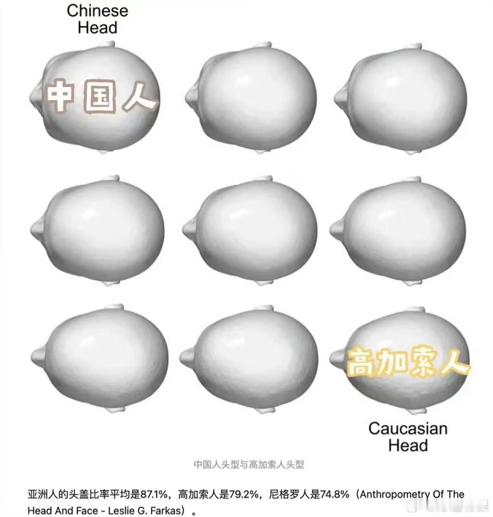 不知道摄影界有没有颧结朝向这个说法。同样高低位置的颧骨，如果颧结面朝外，上镜面部