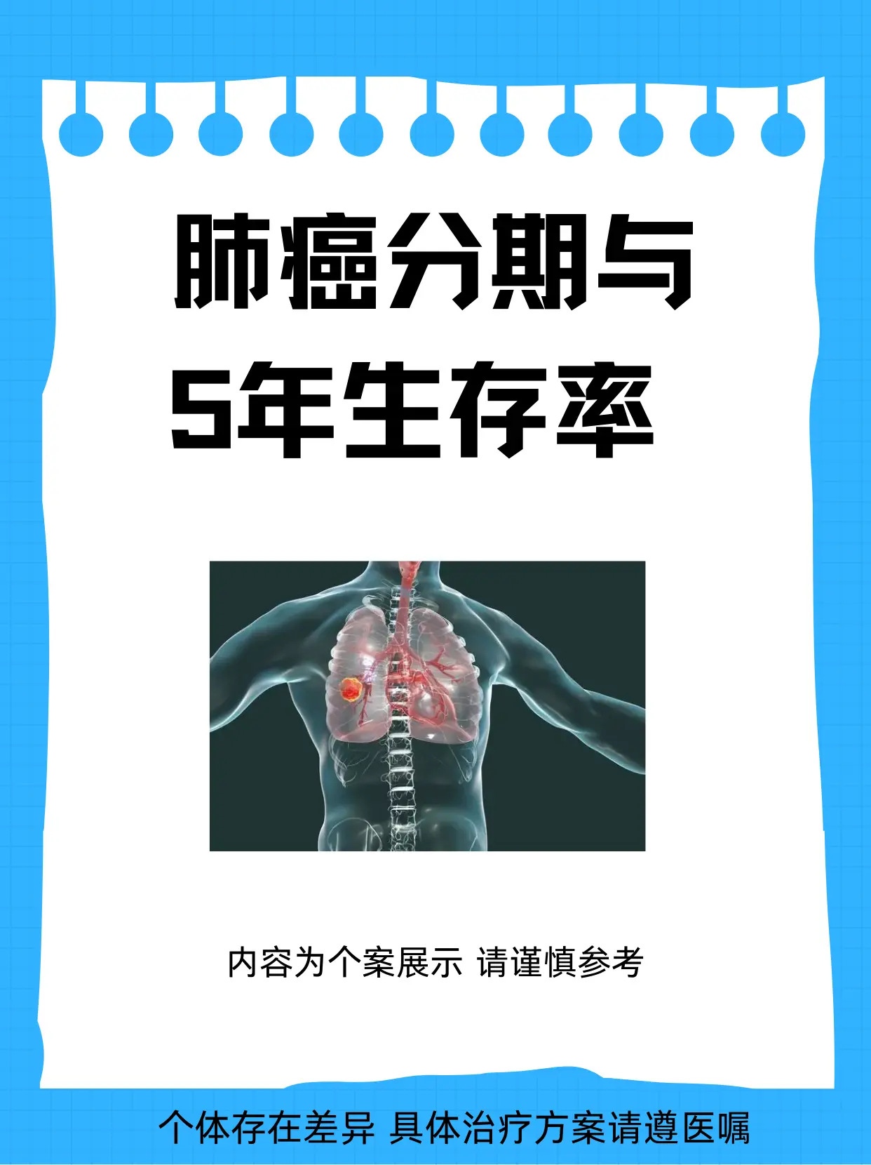 肺癌分期与5年生存率！