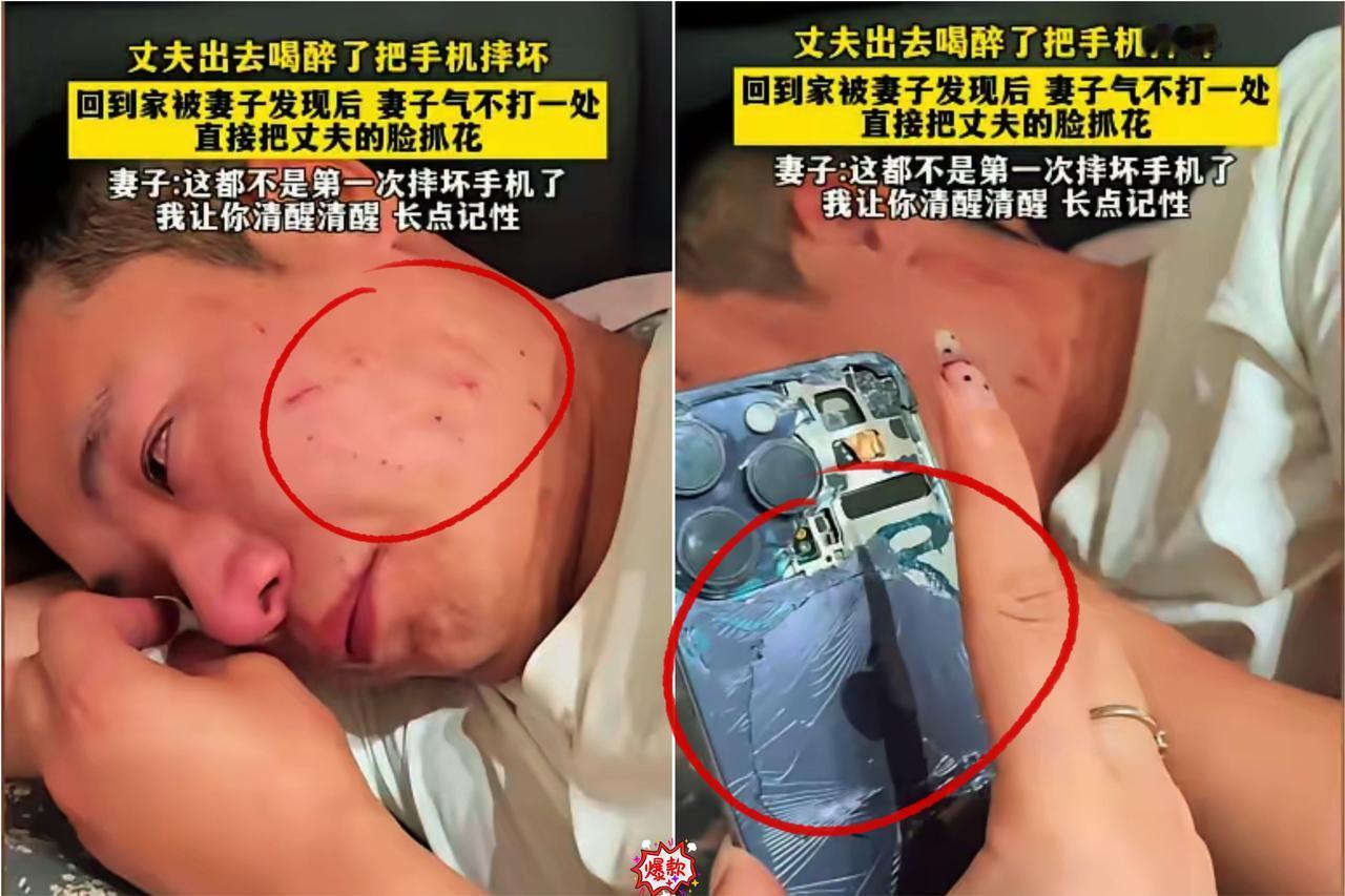 刷到这事儿我真惊了！丈夫喝醉酒摔了手机，回家被妻子抓花脸，妻子还说“让你长记性”