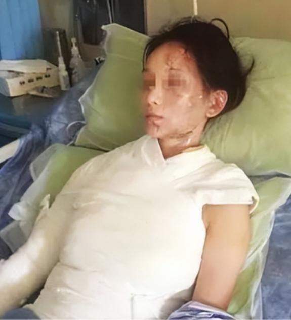 “这就是嘴欠的下场！”浙江，只因5分钟等汤、几句恶语辱骂，28岁女子被一盆滚烫开