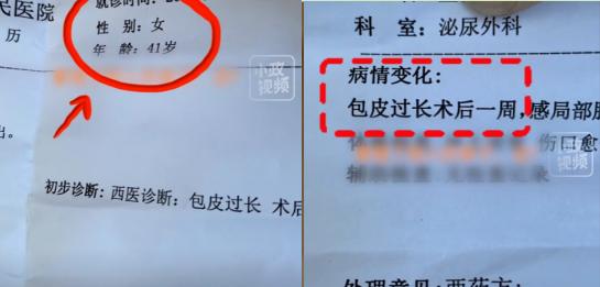 炸裂！江苏女子身体不适，去医院检查被诊断出包 皮过长，院方工作人员看完诊断后大笑