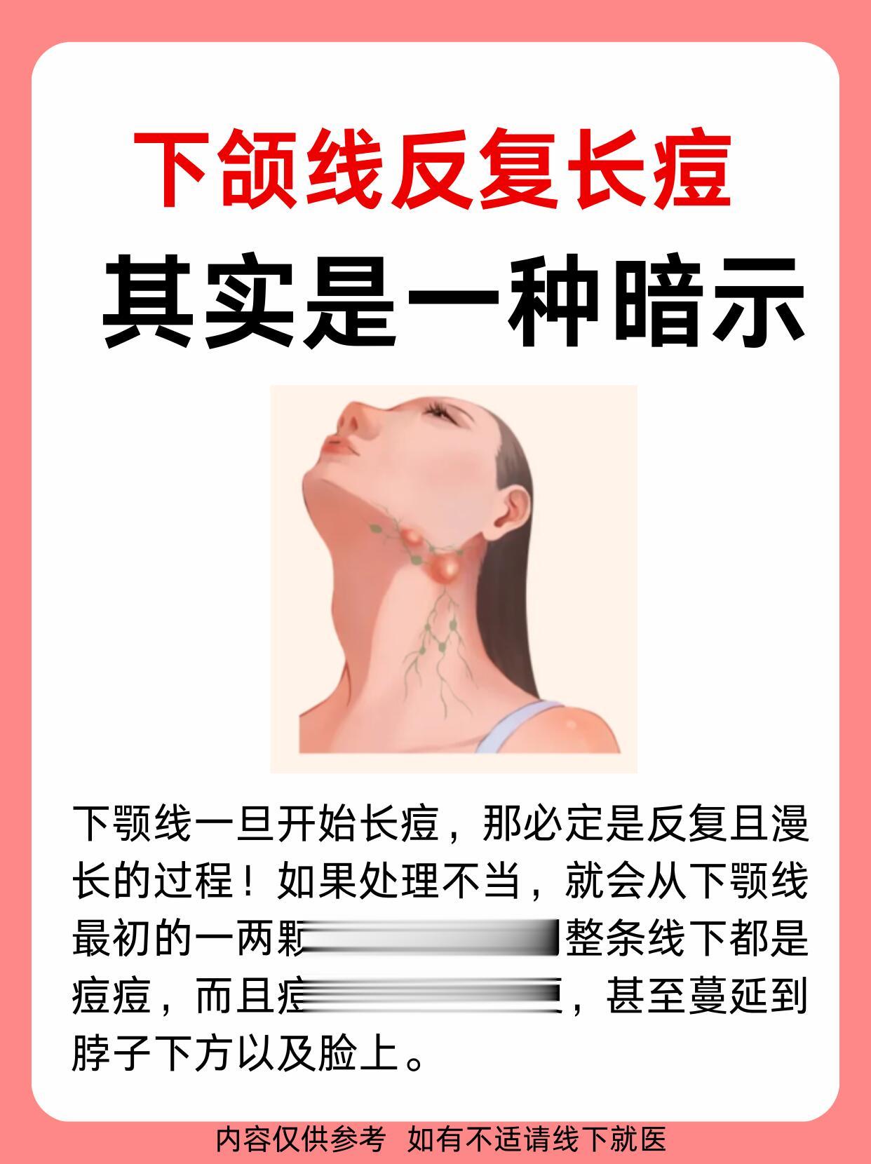 注意!20+下颌线反复长痘怎么办?痘痘肌肤如何拯救痘痘肌