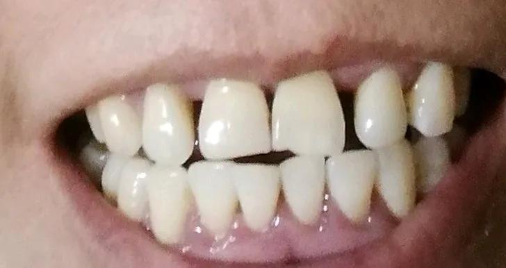 44岁中年妇女的我发现越来越多的小毛病！
1、白发渐多！这个倒无所谓，要是不喜欢