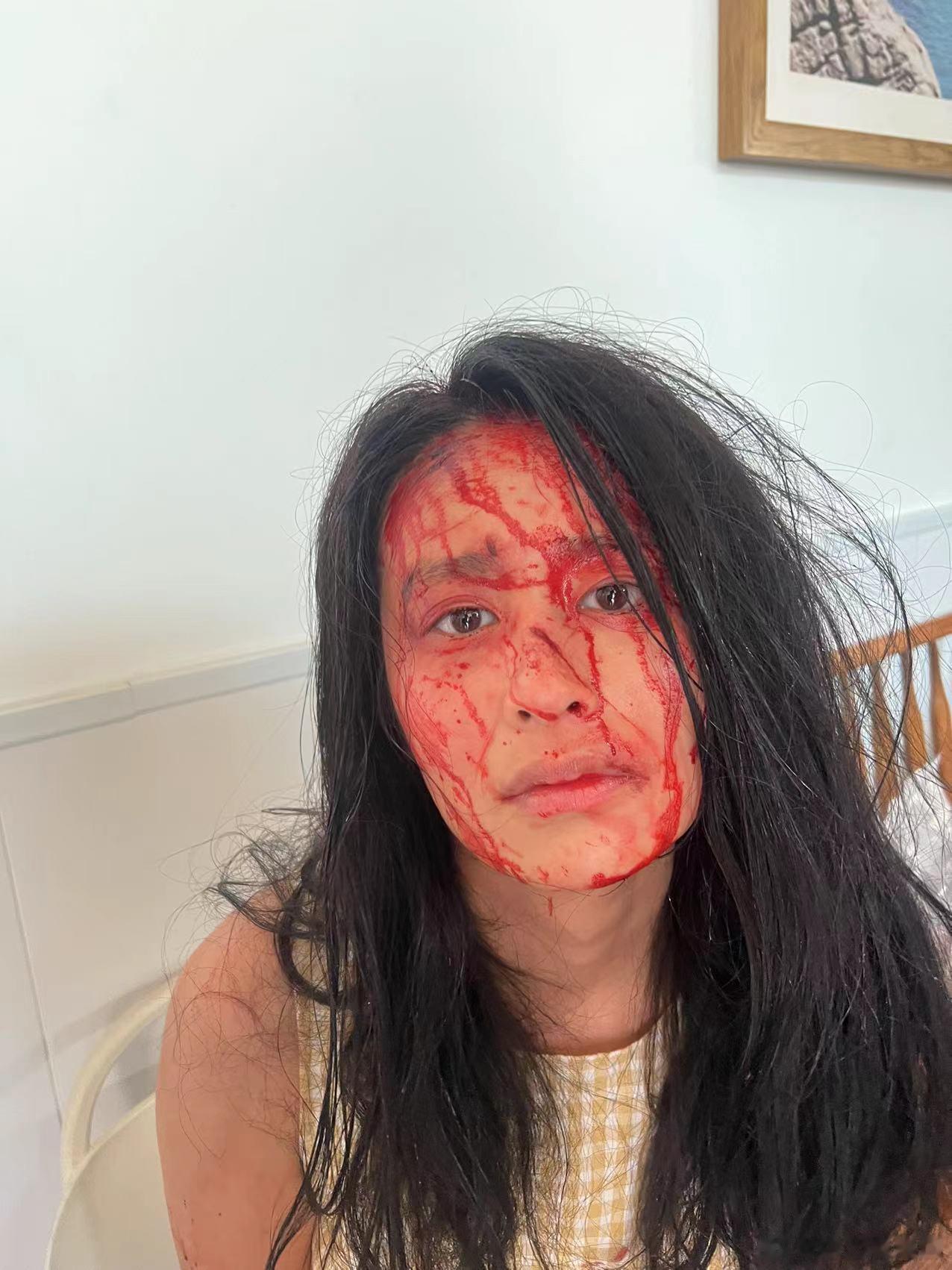 #没认出来这是颖儿# 凌乱的头发，满脸的淤青红肿，真的一眼看过去都是会非常心疼她