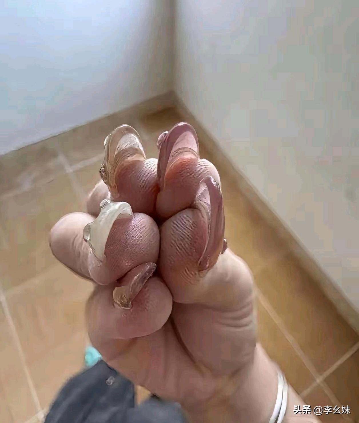 这美甲做的跟灰指甲似的