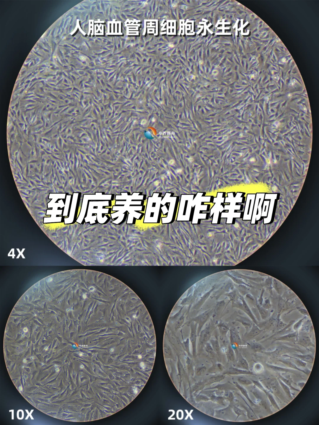 人脑血管周细胞永生化，咱这手法养的针不戳