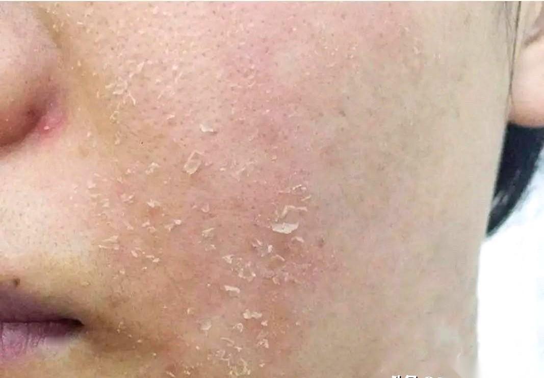 每次去药店，看着那面墙一样的药膏，我就想笑。
红霉素，莫匹罗星，糠酸莫米松，酮康