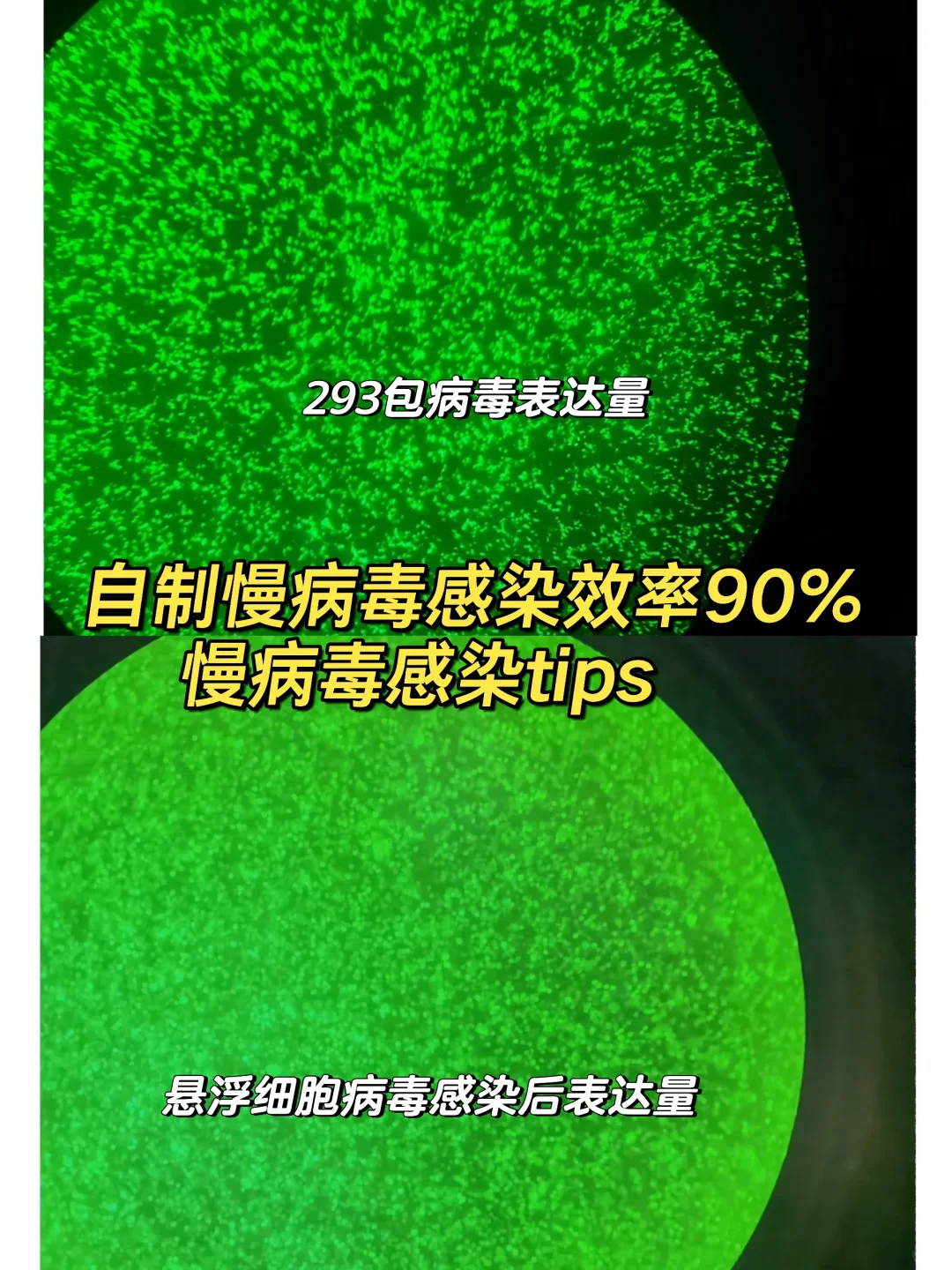自制慢病毒感染悬浮细胞效率90%